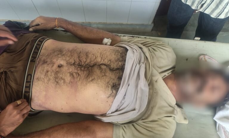 आकाशीय बिजली गिरने से एक व्यक्ति की मौत,ग्रामीणों के लिए अंतिम संस्कार करना बना चुनौतीपूर्ण